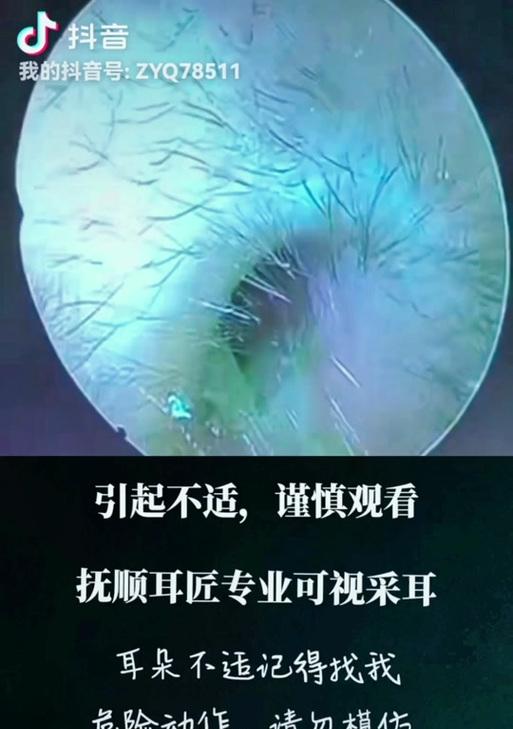 采耳抖音视频剪辑技巧有哪些？如何提高视频质量？