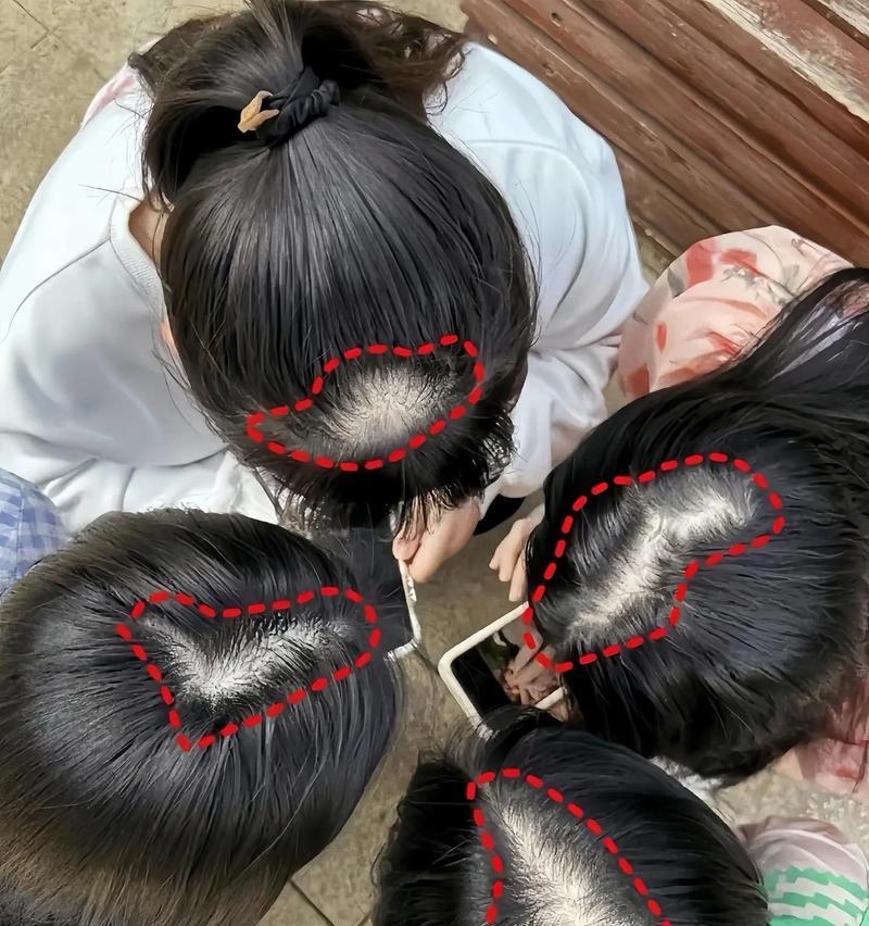 抖音剪辑如何制作人物秃头效果？步骤和技巧是什么？